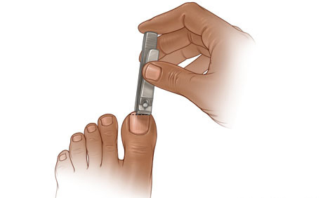 trimming toenails